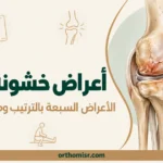 اعراض خشونة الركبة