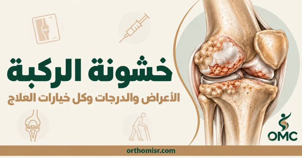 خشونة الركبة