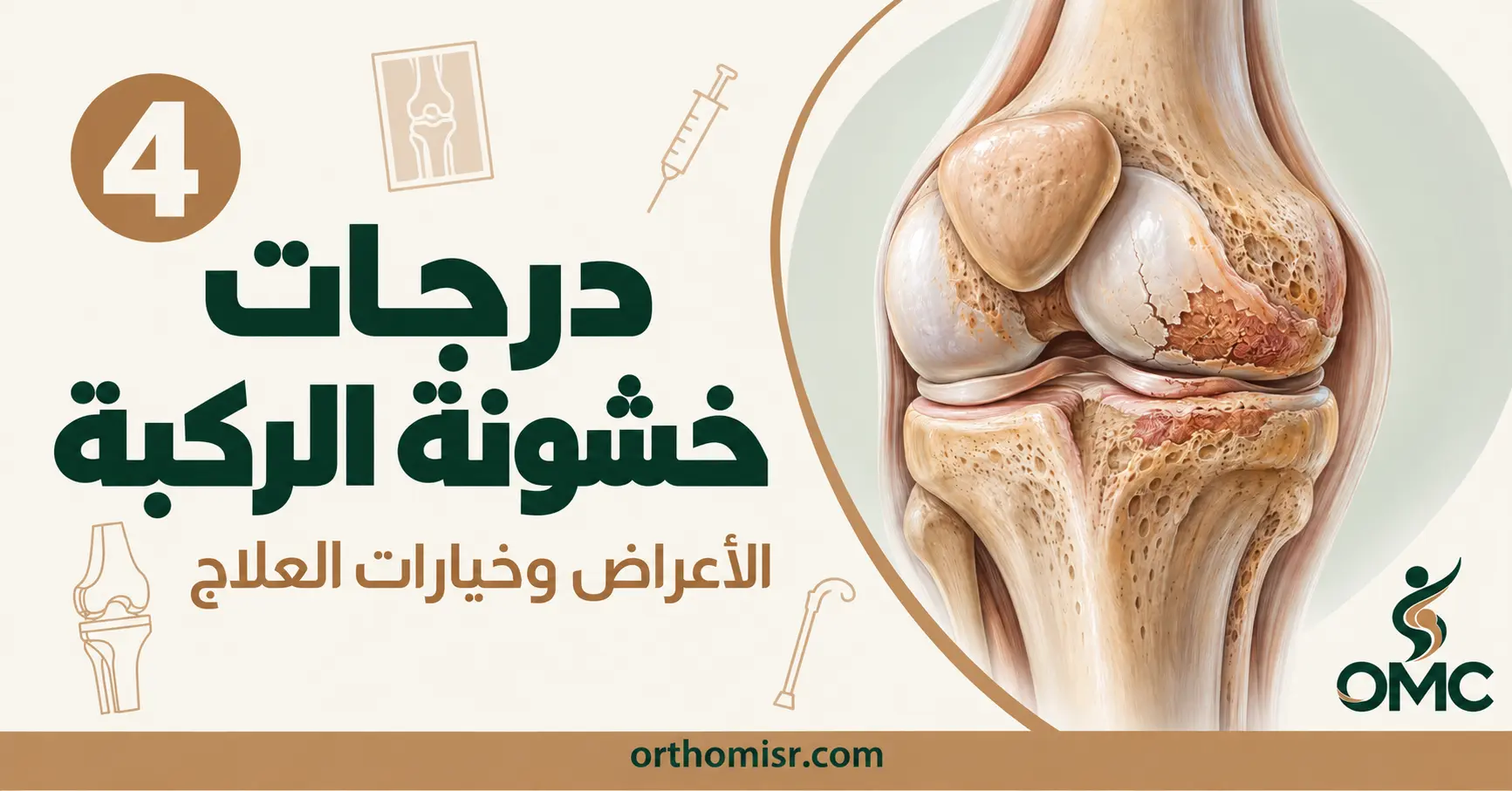 درجات خشونة الركبة