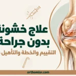 علاج خشونة الركبة بدون جراحة