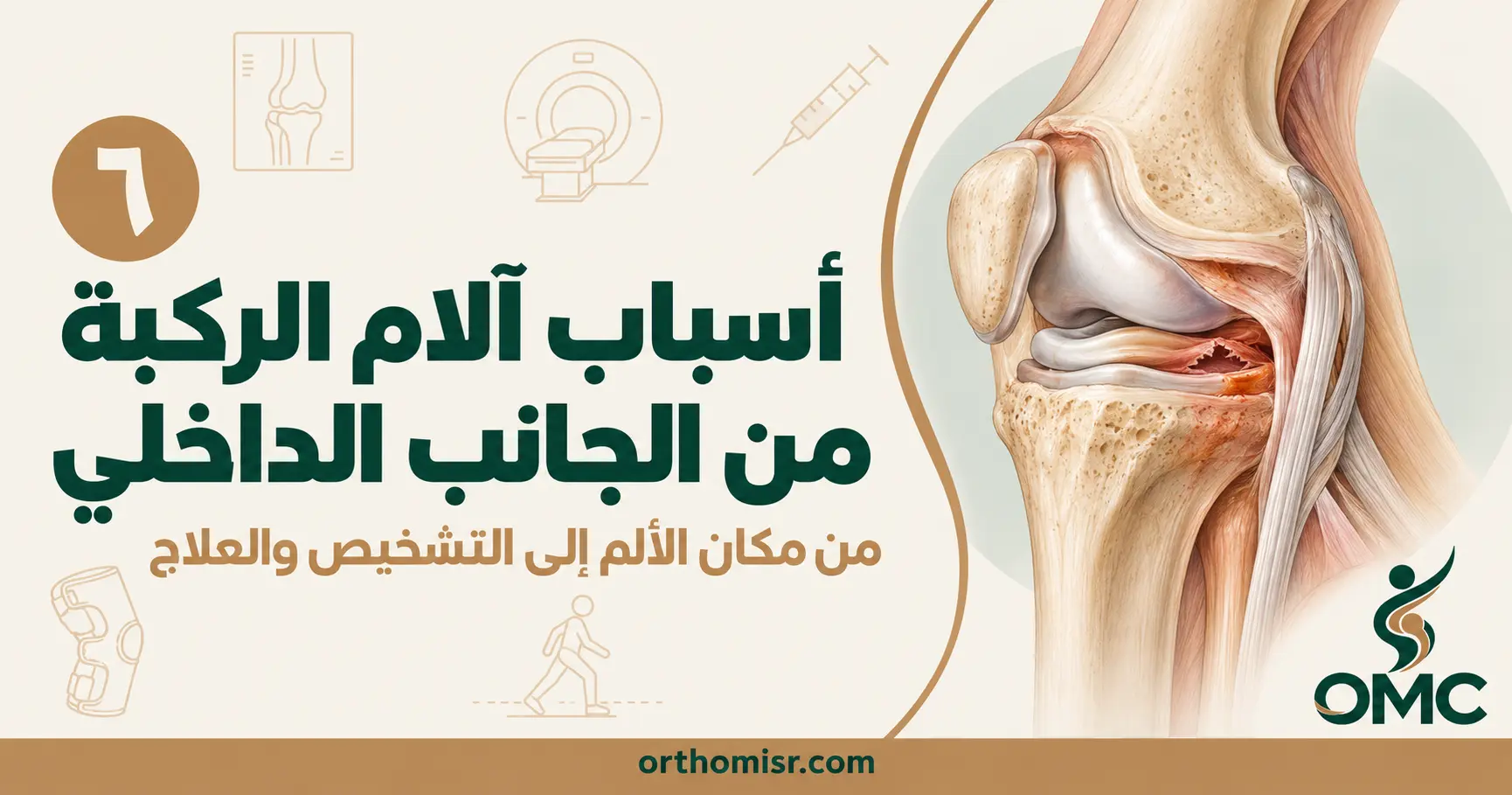 أسباب آلام الركبة من الجانب الداخلي