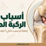 أسباب ألم الركبة المفاجئ