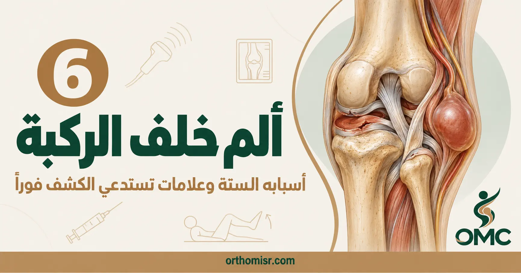 ألم خلف الركبة