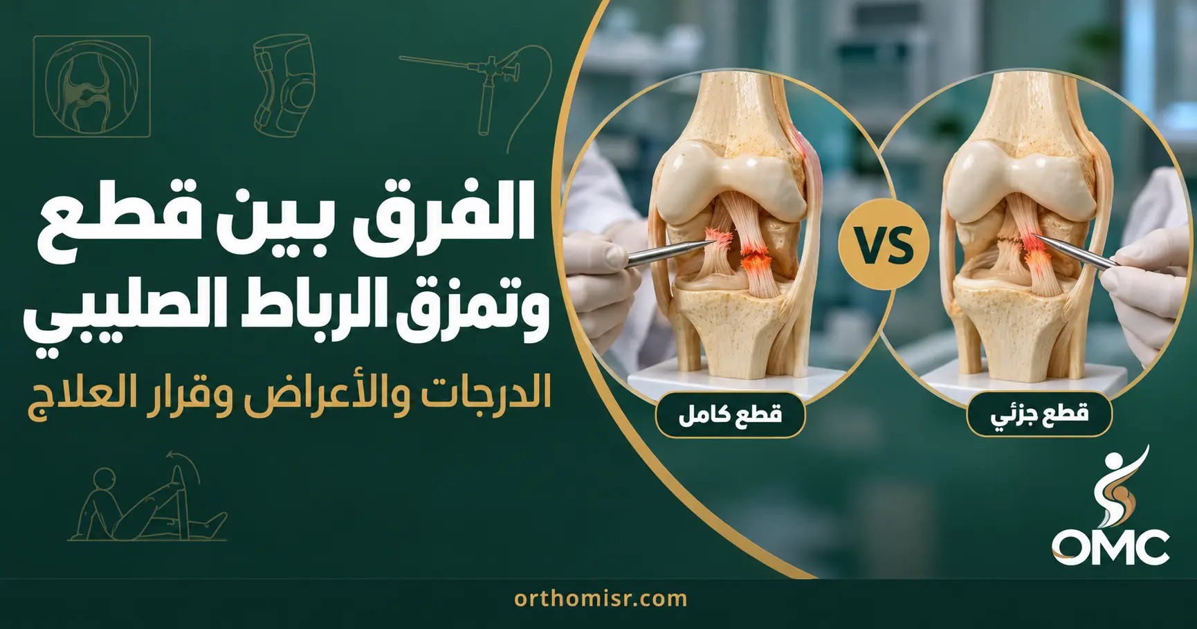 الفرق بين قطع وتمزق الرباط الصليبي