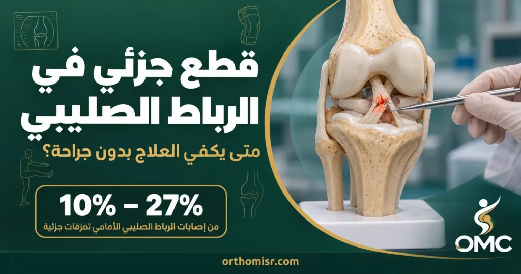 قطع جزئي في الرباط الصليبي: متى يكفي العلاج بدون جراحة؟