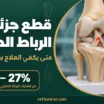 قطع جزئي في الرباط الصليبي